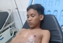 Tak Terima Anaknya Dibakar, Orang Tua Korban Buat LP Ke Polsek Ternate Utara